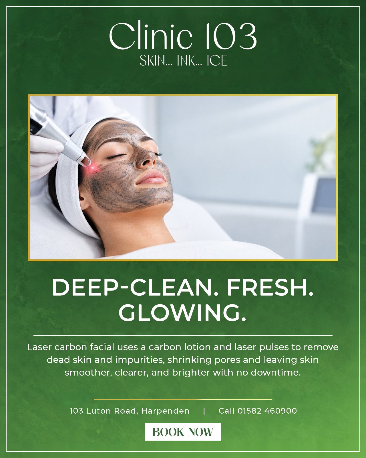 Laser carbon facial treatment at Clinic 103 Harpenden — Deep-clean, fresh, glowing skin